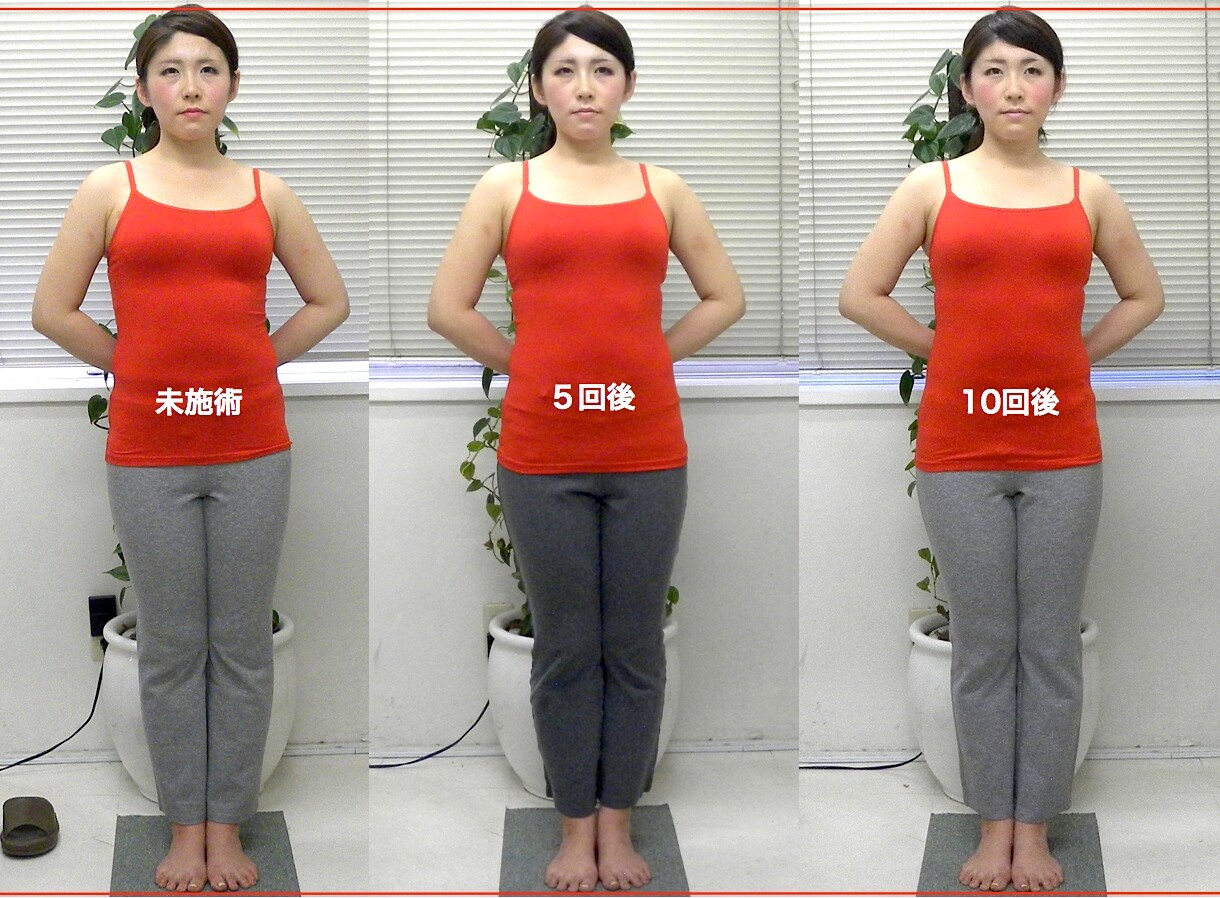 小顔矯正・骨盤矯正であなたがどう変わるか イメージ1