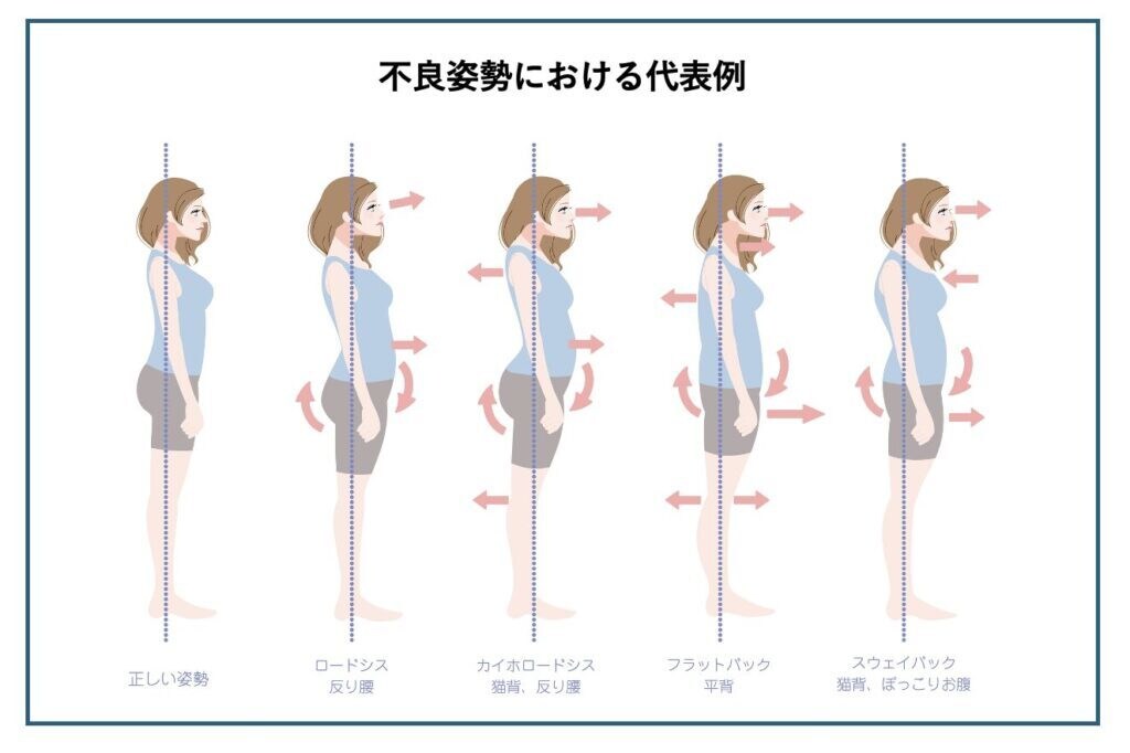 特別価格！写真2枚で姿勢診断＆改善提案します 誰にでもわかりやすく現役ピラティスインストラクターが診断。 イメージ5