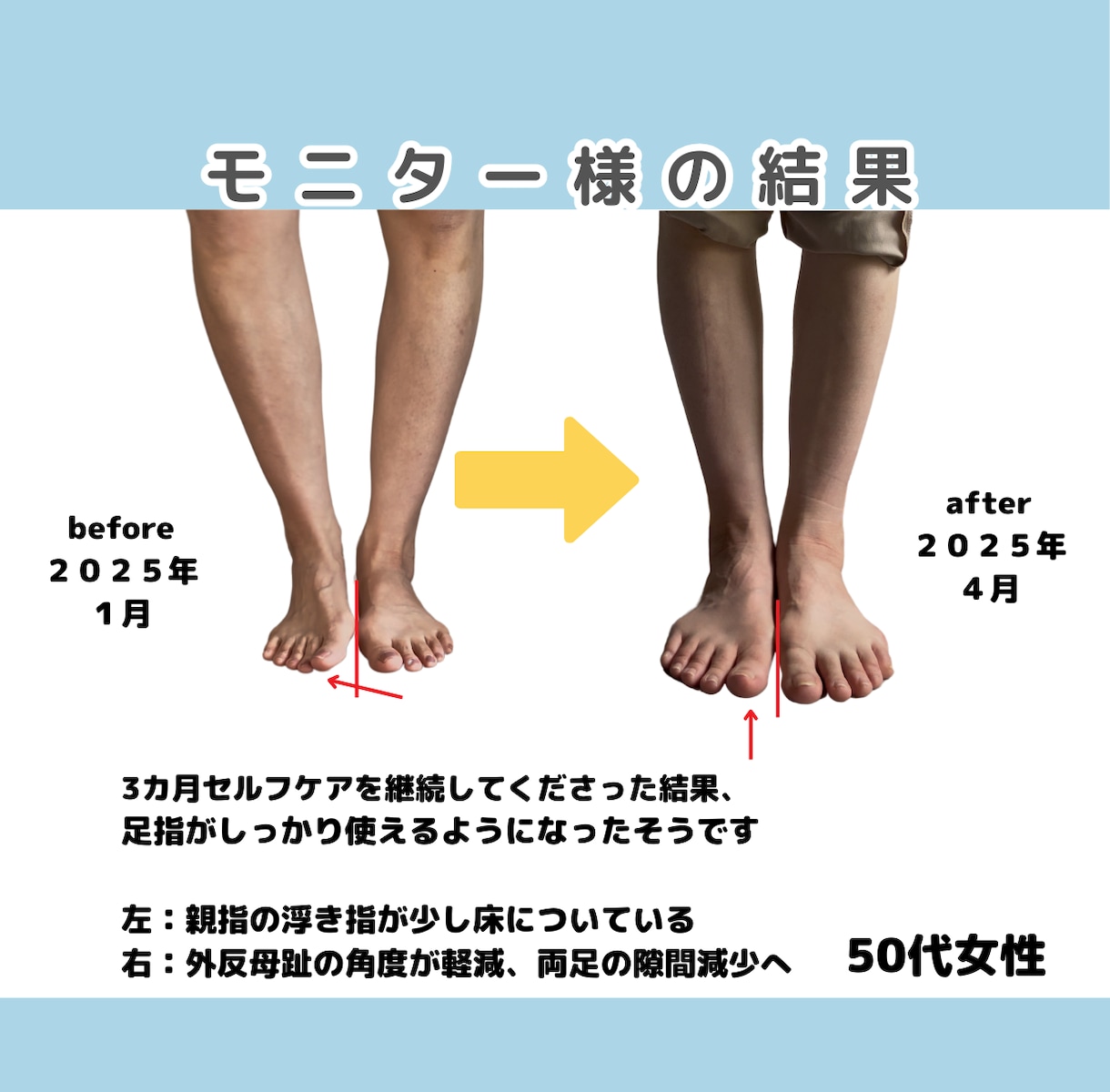 3ヶ月集中！足指×姿勢を整えます 【ラクに動ける体へ。セルフケアと姿勢のクセをアドバイス】 イメージ8
