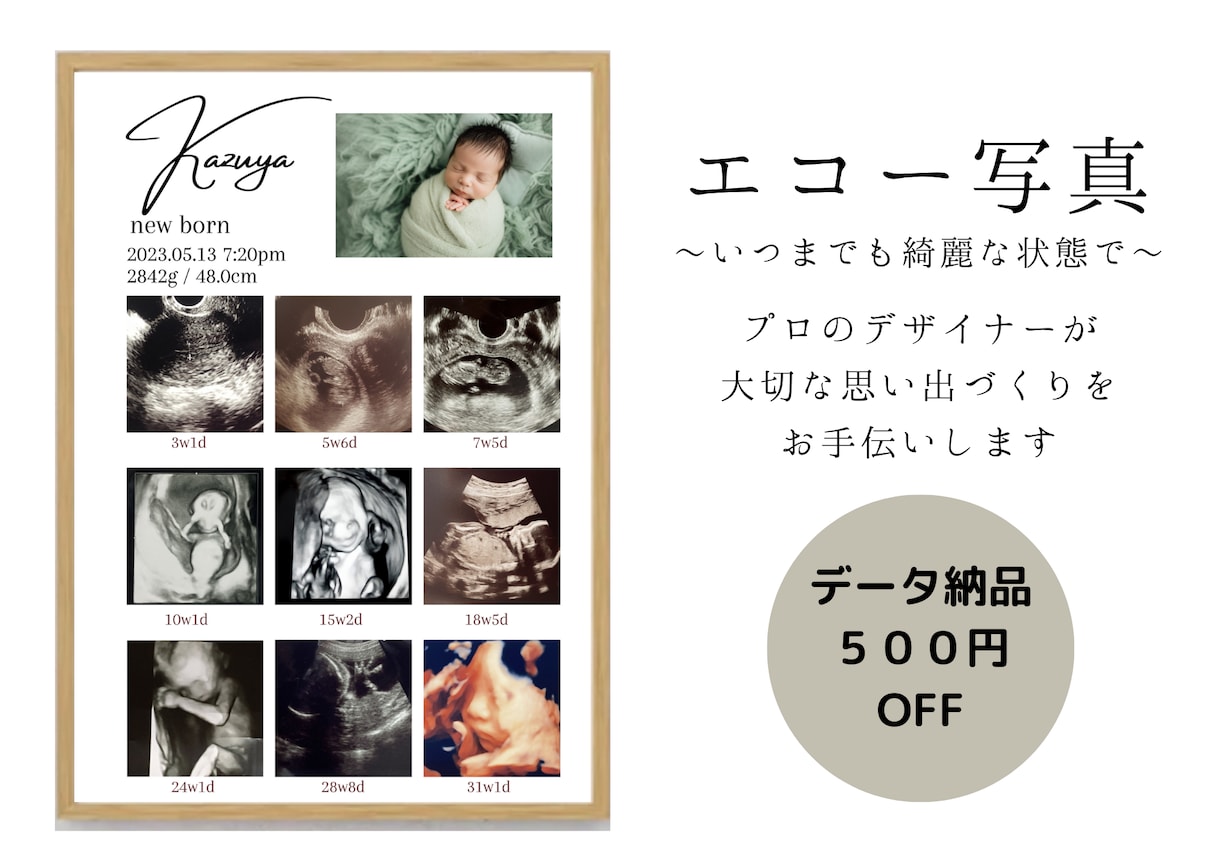 赤ちゃんの写真入りエコー写真ポスター作ります 大切な赤ちゃんの思い出をおしゃれに残しませんか？ イメージ2