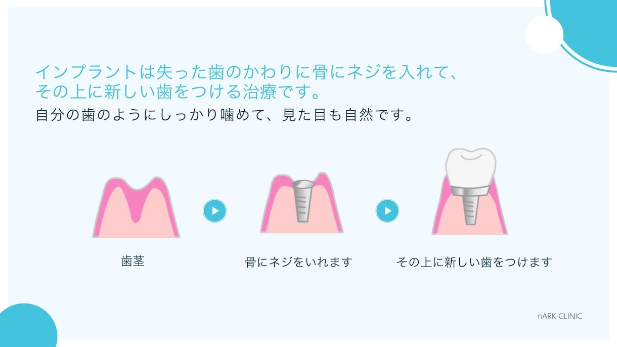 現役看護師が手術などのIC動画制作します 業務効率化・説明の抜け防止に最適！丸投げOK！ イメージ7