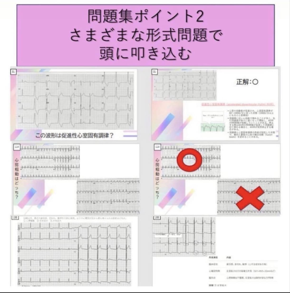 心電図検定3級勉強資料セットをお売りします 心電図検定1級取得者が作成した3級試験対策セット！ イメージ2