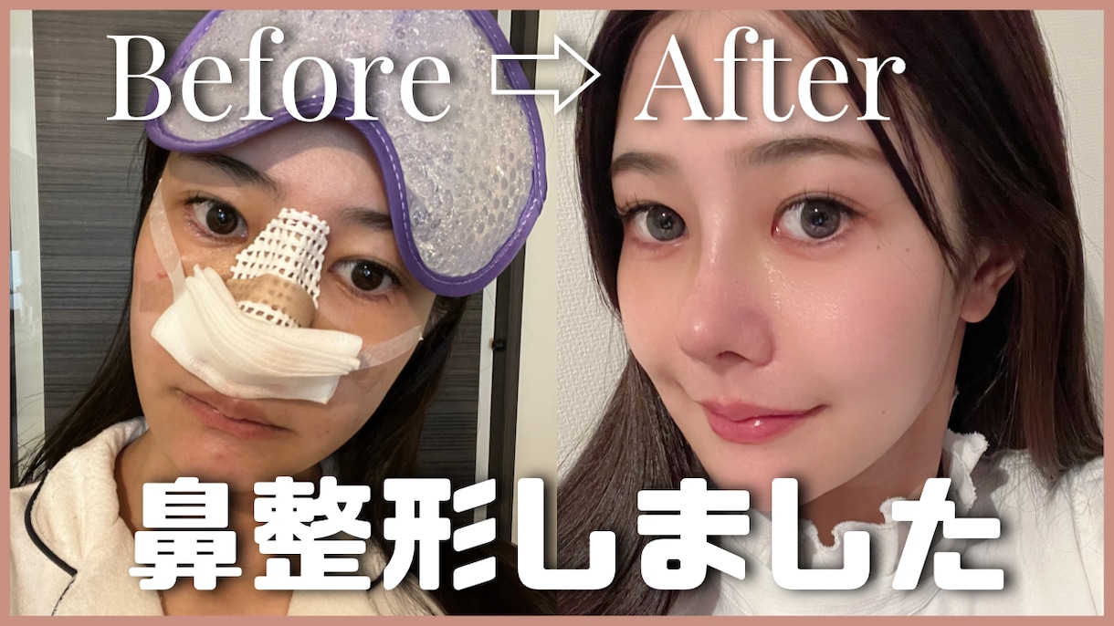 元美容カウンセラーがあなたの写真で整形診断します プロ目線で、どの施術が必要なのか的確にアドバイス。 イメージ1