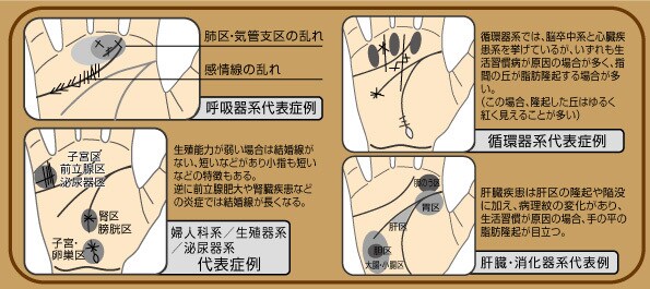 掌紋医学の手相診断で身体の弱い所をお伝えします 将来的疾患リスク、健康運を専門的な手相鑑定で簡単チェック イメージ7