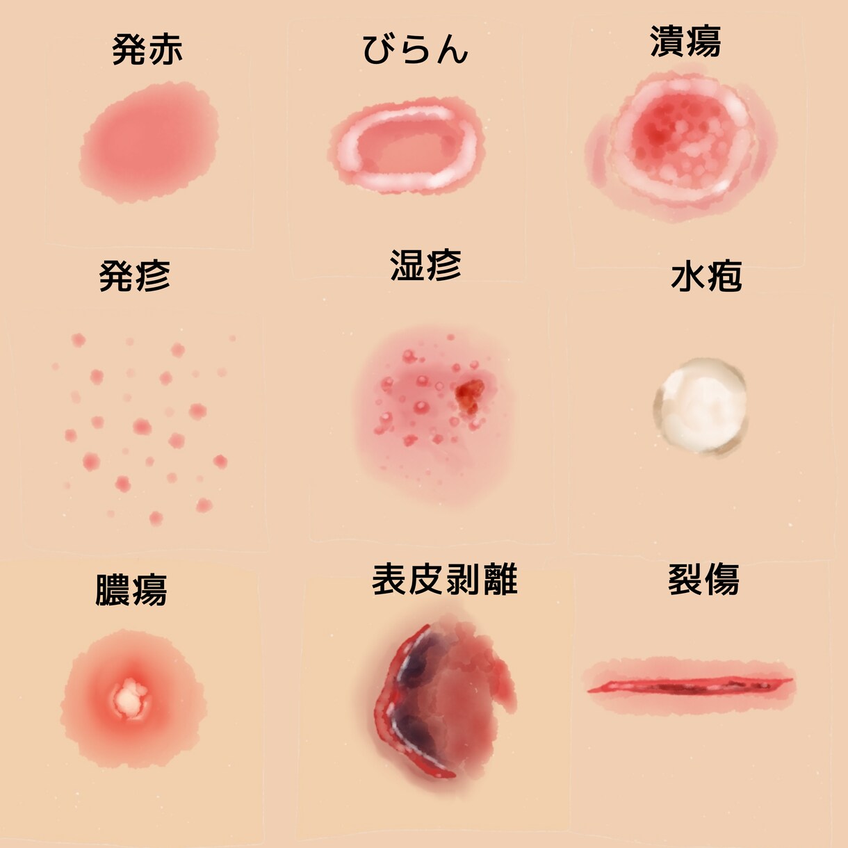 医療をわかりやすく図解イラスト作成します 勉強と臨床のズレを埋める医療ビジュアル制作します イメージ4