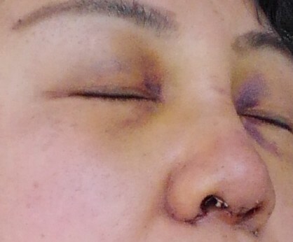 美容整形した方がいい場所教えます 美容整形、どこをしていいのか？悩んでる方。 イメージ1