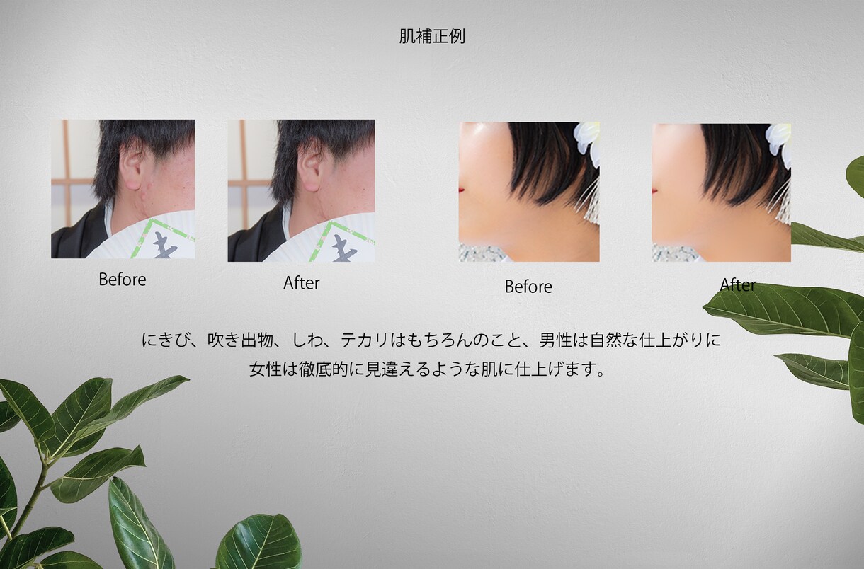お好きな写真でウェルカムボードをつくります ニキビ、吹き出物、肌のトラブル、徹底的にお直しいたします。 イメージ8