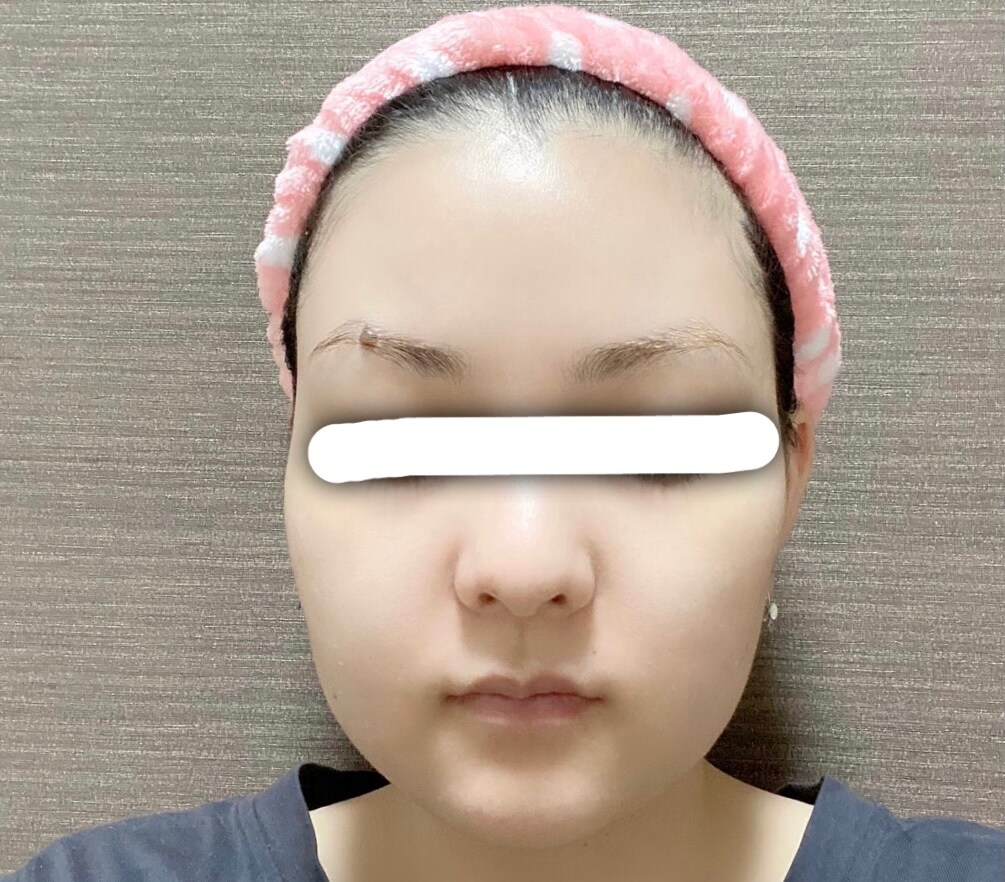 高級品ほぼ意味ナシ！本当に効くスキンケア教えます 肌年齢35歳から16歳に変わった時に実践して効果が出た方法！ イメージ1