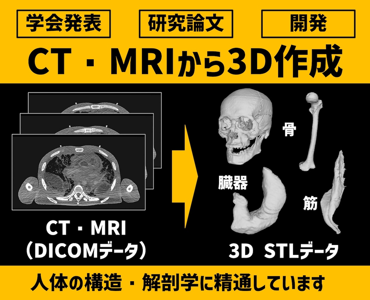 研究開発向け｜医療画像から3Dデータを作成します CT・MRIから人体構造の3Dデータを作成します イメージ1