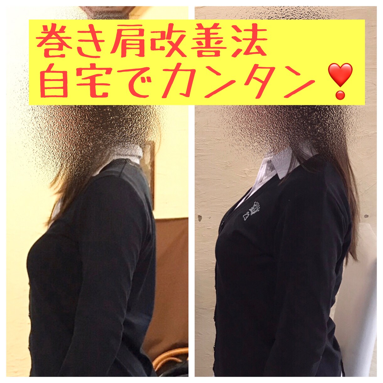 巻き肩の修正方法お教えします 現役整体師が何故巻き肩になるのか、それを改善する方法を伝授 イメージ1