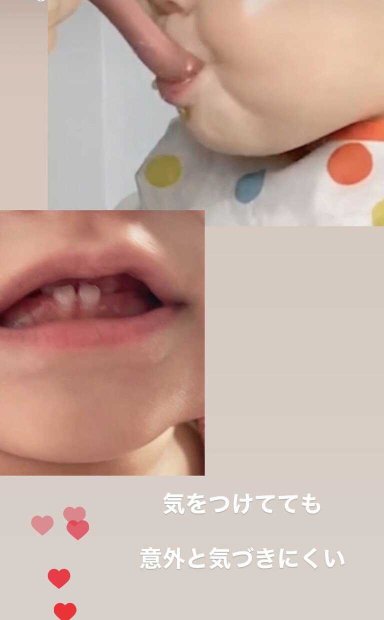 お口のお悩み(歯磨き.歯並び.離乳食)相談承ります ＊全身の発達＆姿勢から矯正なしのお口を育てる歯科衛生士が対応 イメージ7