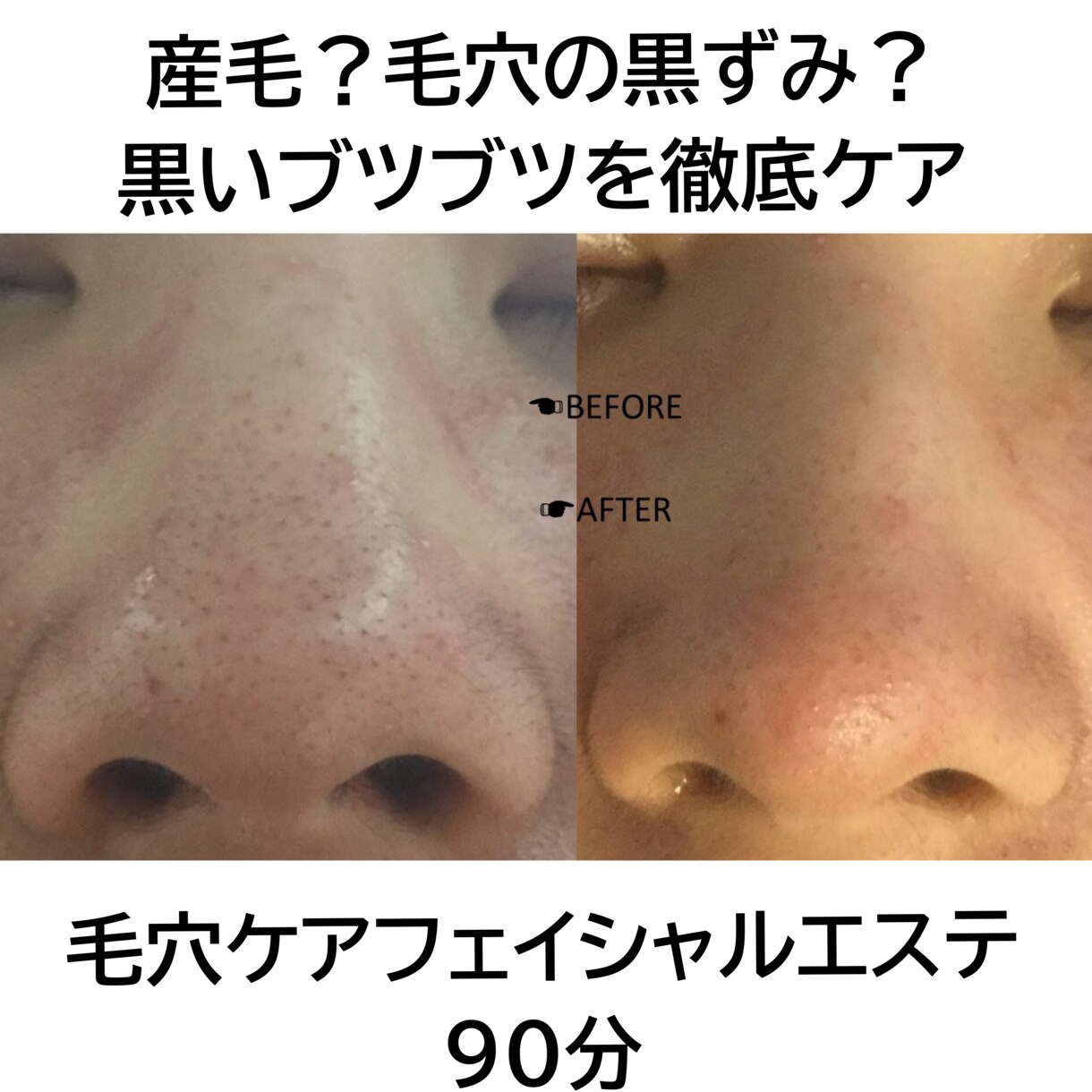 超敏感肌・アトピー肌のホームケをお教え致します ひとりひとりの生活に合わせたホームケアとスキンケアをご紹介 イメージ4