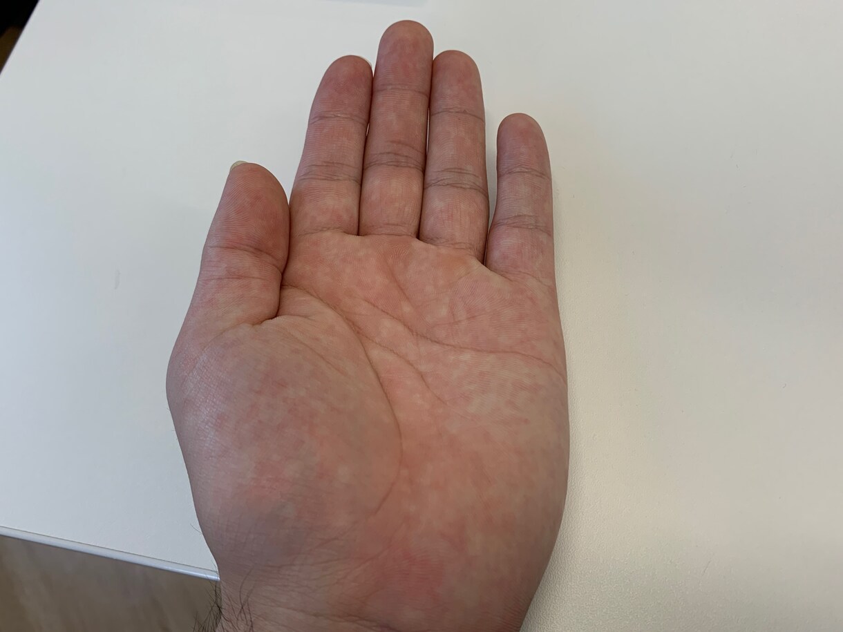 あなたの手相をお時間をかけて占います 撮った写真、できればサイズの大きい手の画像をお送り下さい。 イメージ1