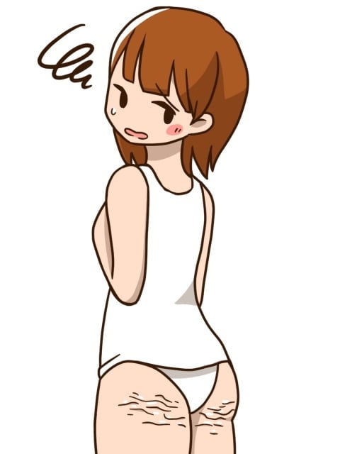 セルライトも消えいくダイエット法…伝えます 1か月たたずに実感！運動や痛い目なしで体も引き締めまった イメージ3