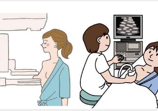 乳がん検診が不安な方、相談に乗ります チャットでマンモグラフィーＡ認定技師がお答えします。 イメージ1