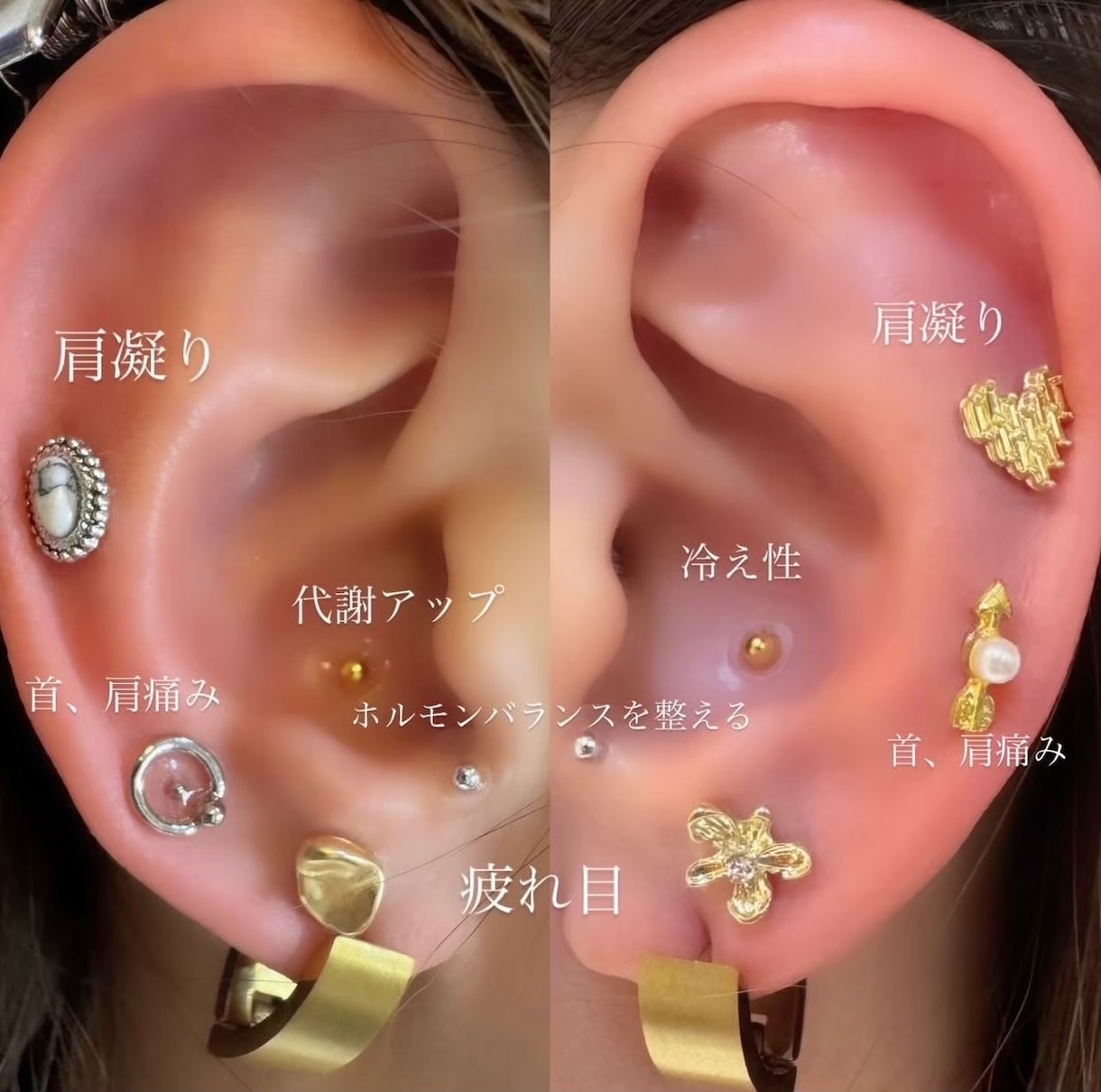 初心者歓迎！耳つぼJ講座フルサポートします セルフケアで『すぐ使えるツボ』を学べる人気講座 イメージ3