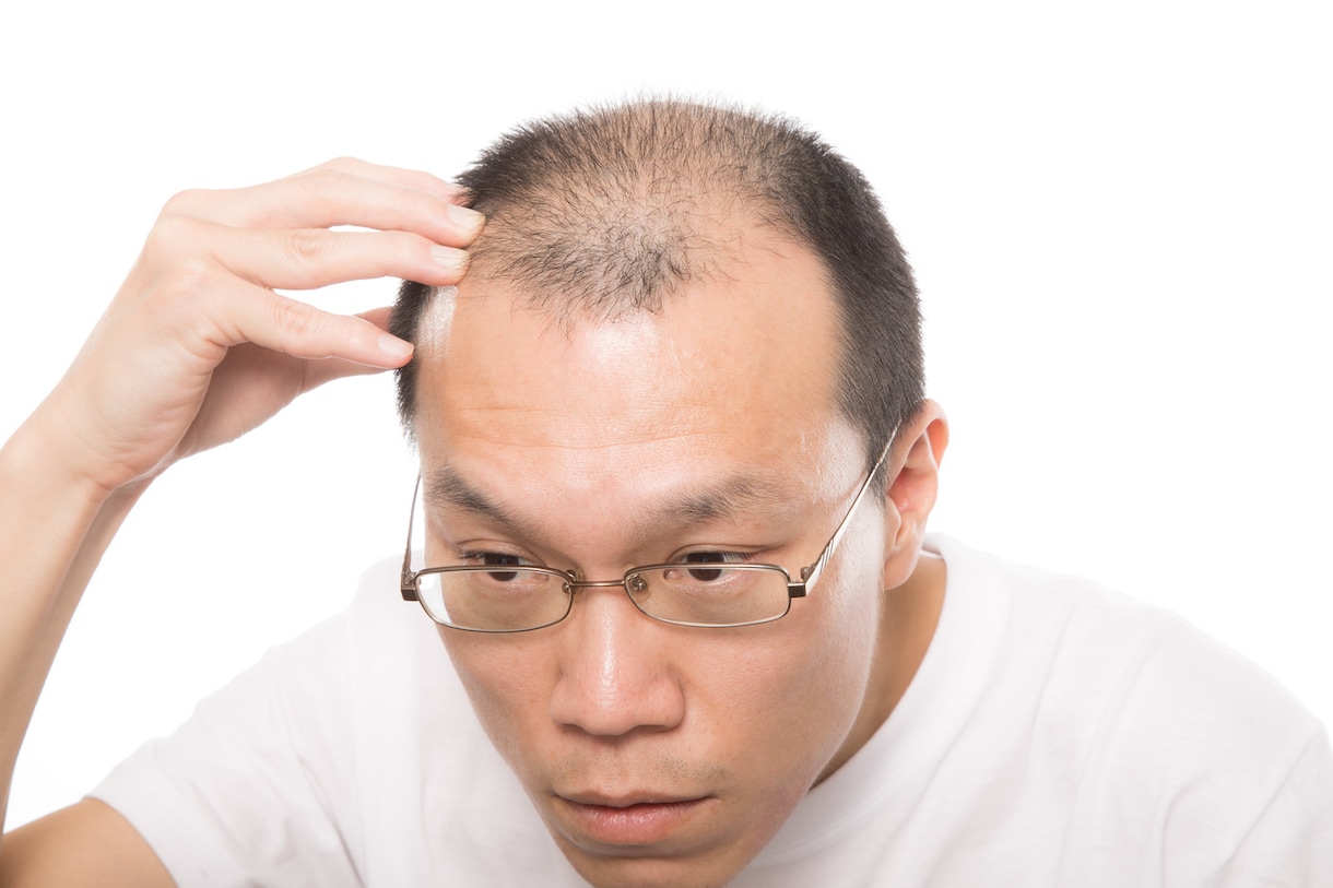育毛・発毛・抜け毛の原因・一般論をお伝えします これであなたも髪の悩み無し！〜髪の毛の一般論を知ろう〜 イメージ3