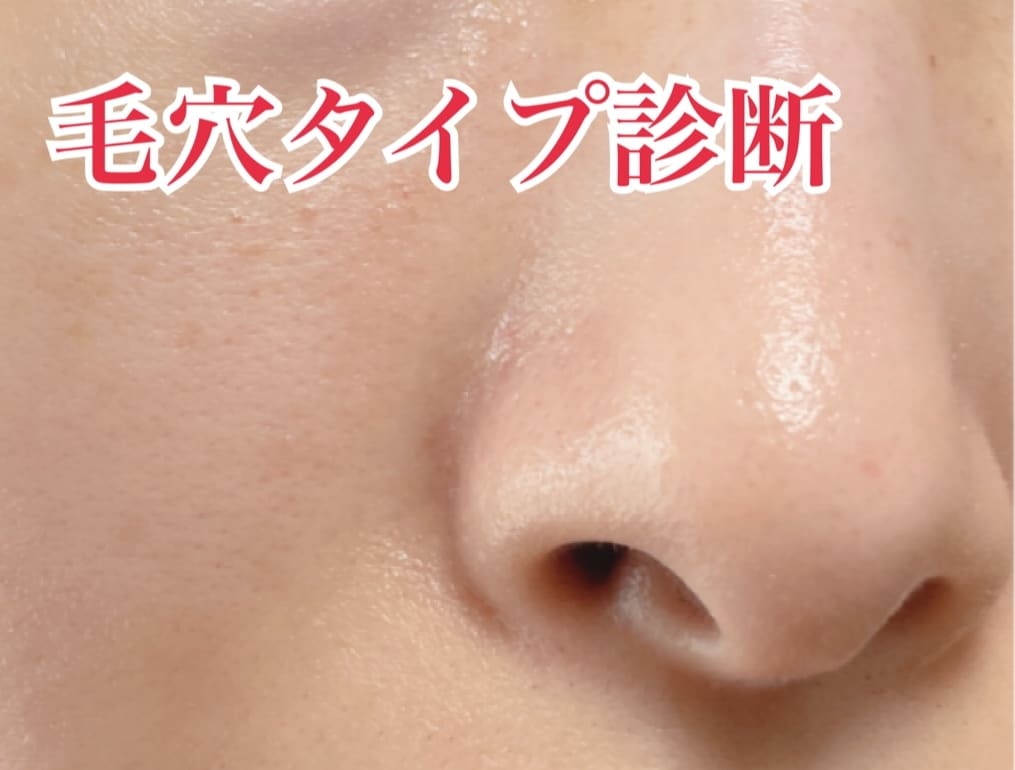 毛穴専門店エステティシャンが毛穴タイプ診断をします あなたの毛穴タイプをお伝えし美肌へのお手伝いをします。 イメージ1