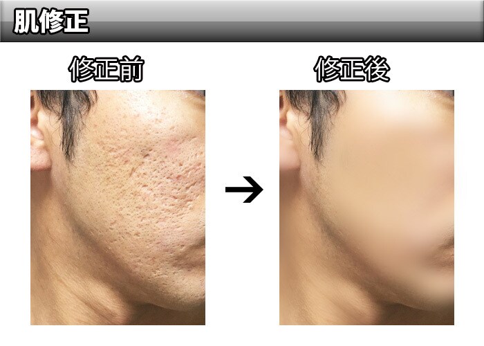 画像修正承ります SNSやプロフ写真、思い出の写真修正します イメージ1