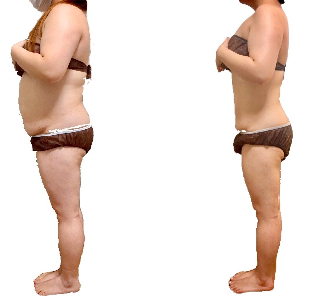 ダイエットについての相談のります ダイエット専門家が痩せないあなたへアドバイスいたします イメージ2