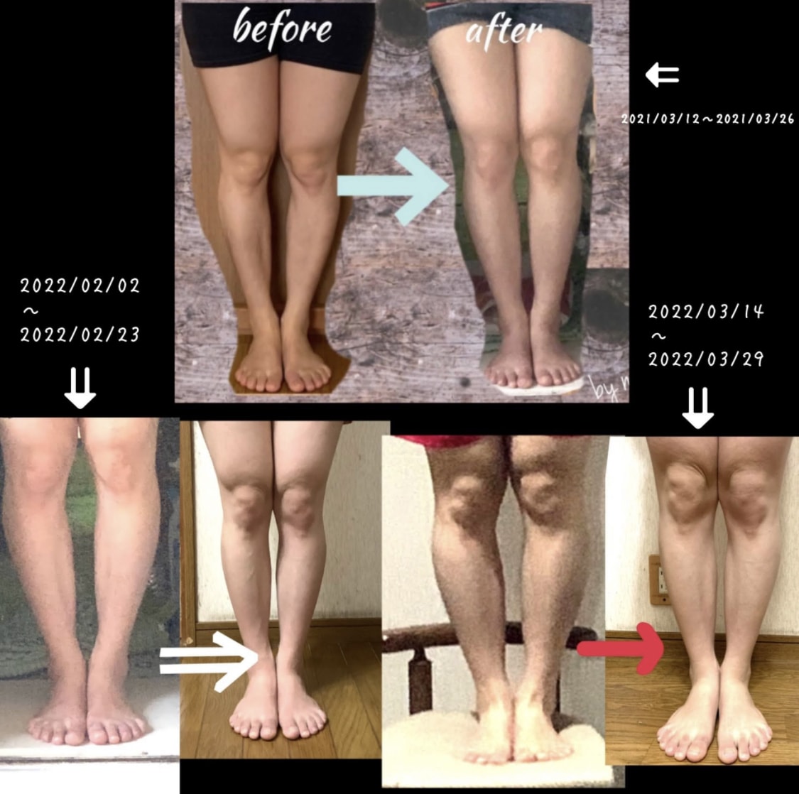 オンラインで整体を行います 改善後、自分でコントロール(キープ)できる！体作りを行います イメージ5