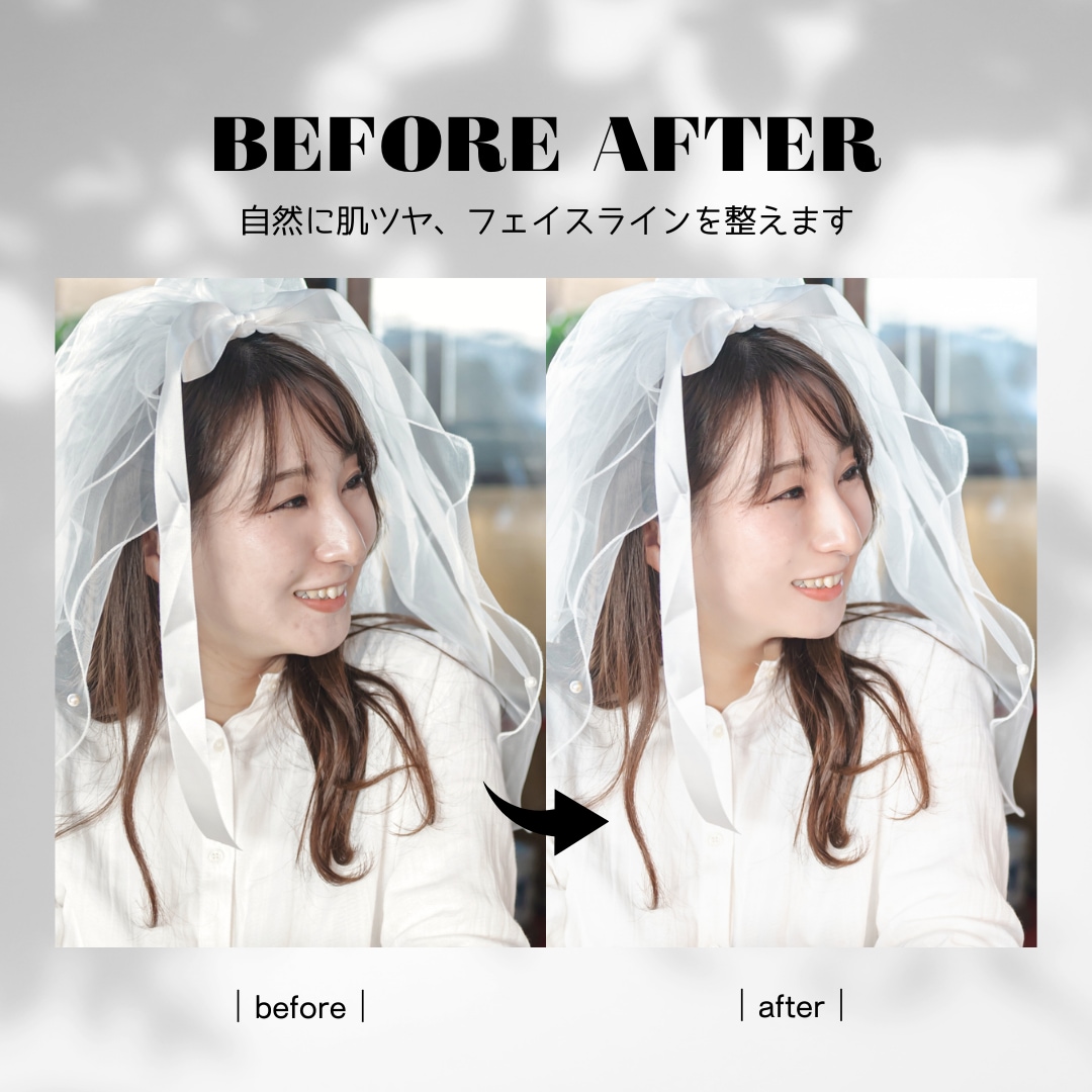 自然な美肌補正、大切な写真を最高の仕上がりにします 「加工した感」を出さずに、理想の自分へ。 イメージ1