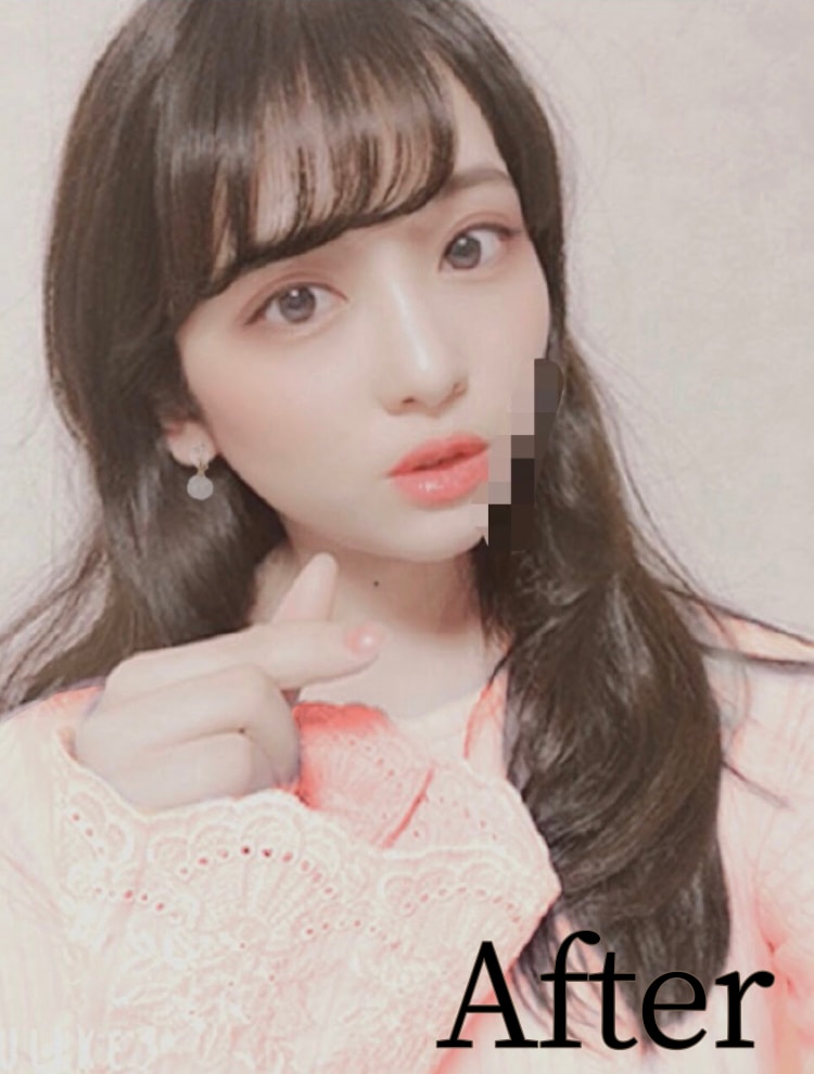 あなたの自撮りをとびきり可愛くします ばっちばちの加工からナチュナルな加工まで貴方を可愛くします！ イメージ4