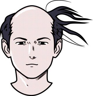 薄毛でお悩みの方。格安！私の成功法お教えします 若禿の私が実際に行い成功した、格安な方法お教えします！ イメージ2