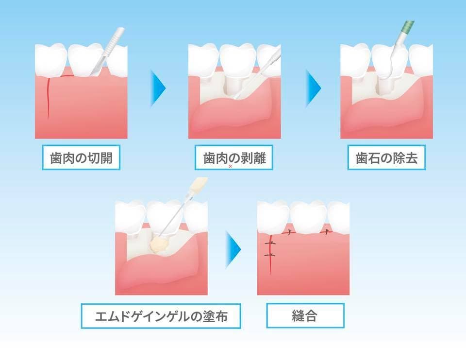 分かりやすい！伝わる！図解・解説イラスト制作します 整形外科・歯科・美容外科様など様々な図解イラストを作成 イメージ5