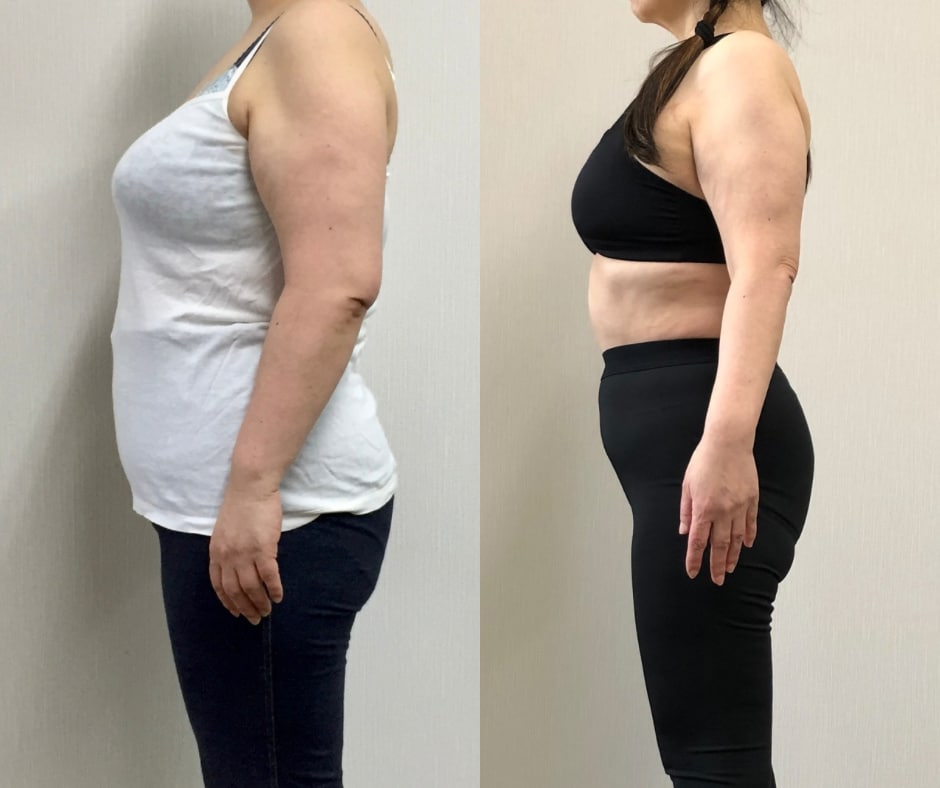 なにしても痩せられない、そのお悩み解決します 57歳パーソナルトレーナーがお悩みに丁寧に寄り添います イメージ3