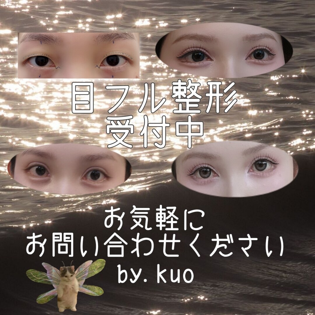 経験者がアドバイス✨目元整形の悩みに寄り添います 目元整形の不安に実体験でお応えします イメージ1
