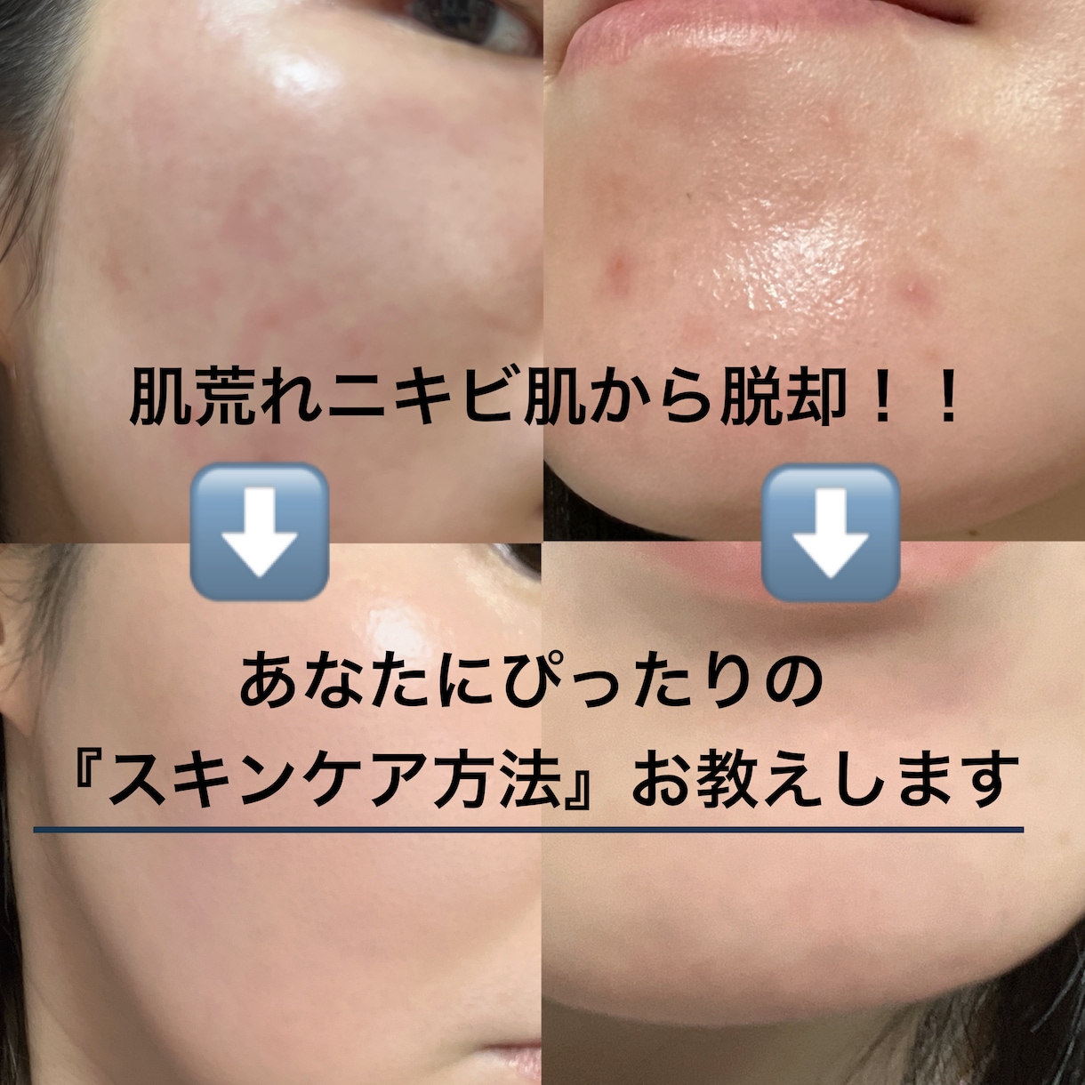 なりたい肌に導く！アナタだけのスキンケア教えます ふと鏡を見た時も笑顔になれるような自信の持てる肌が欲しい方へ イメージ1
