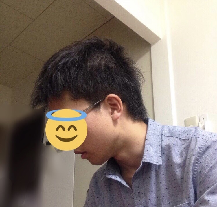 植毛・育毛剤なし！薄毛改善した方法教えます その決断、ちょっと待ってください。 イメージ3
