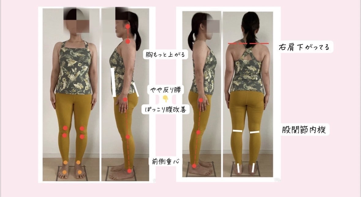 プロが診断！痩せない理由を骨格判断し全て分析します 写真だけでok!お腹、反り腰…あなたの歪みを見える化します！ イメージ9