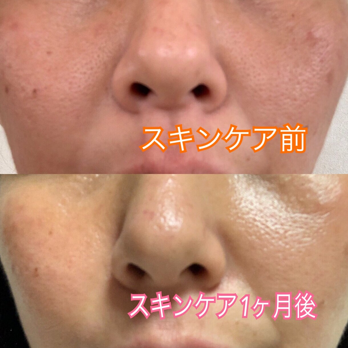 最近の美肌術を教えます あなたの肌に1番適した化粧品、お手入れ方法を教えます！ イメージ4