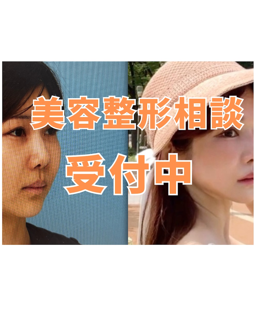 美容整形のお悩み何でも相談に乗ります 顔面課金1000万の経験からお答えします！ イメージ1