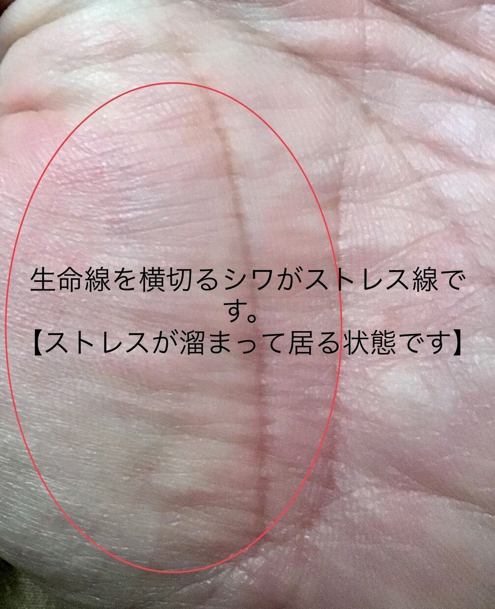 左手専用手相で宿命相を占いますます 先天運生まれ持った不変な宿命ディステニーを占います。 イメージ9