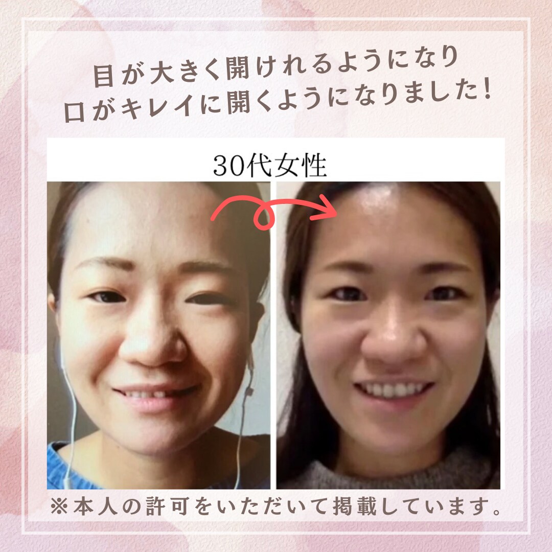 一生使える！セルフ美顔筋エクササイズを教えます 1日5分で若返り！お金をかけずにキレイになれてコスパ◎です！ イメージ3