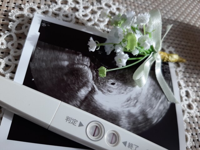元胚培養士が妊活の進め方を専門的に整理します 妊活の迷いを整理して次の一手を見つける イメージ8