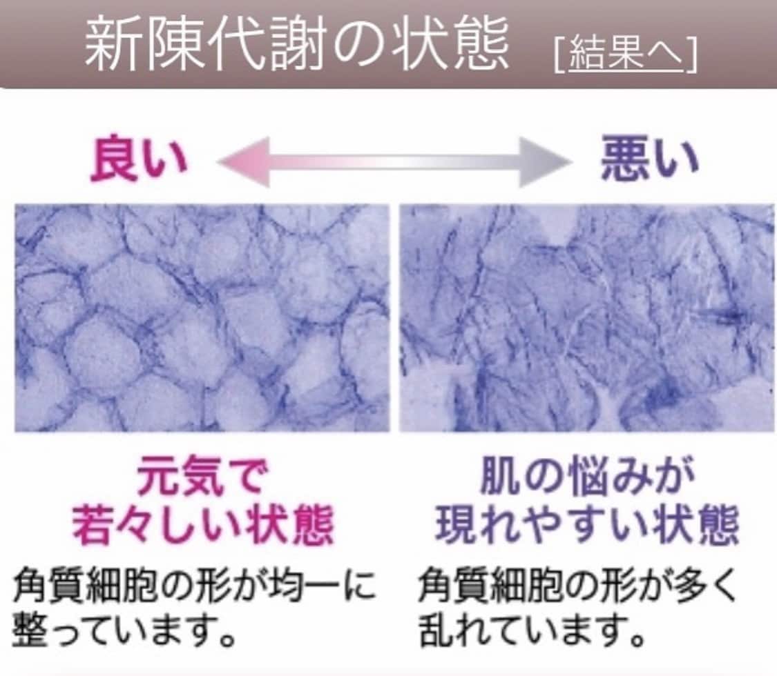 目から鱗のスキンケア基礎知識おしえます 何をしてもキレイになれなかった方ご相談ください！ イメージ4