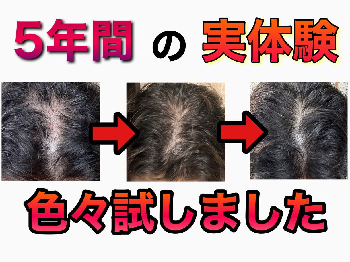男性限定⚠️薄毛を改善させる方法をご提供いたします メンズの薄毛を徹底改善✨9割の増毛効果の実績✅ イメージ3