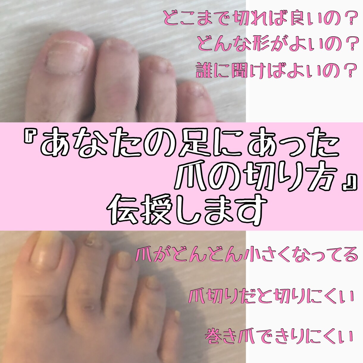 あなたの足に合った爪の切り方を伝授します 爪の切り方って一人1人違うって知ってましたか？ イメージ1