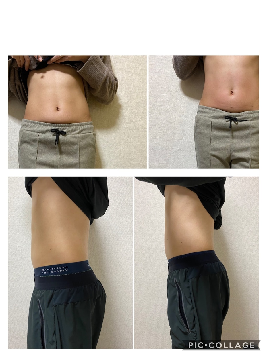 腸活、腸もみオンライン、栄養相談します 免疫力アップ、肌荒れ、腰痛が気になる方へ自宅でできる腸活 イメージ1