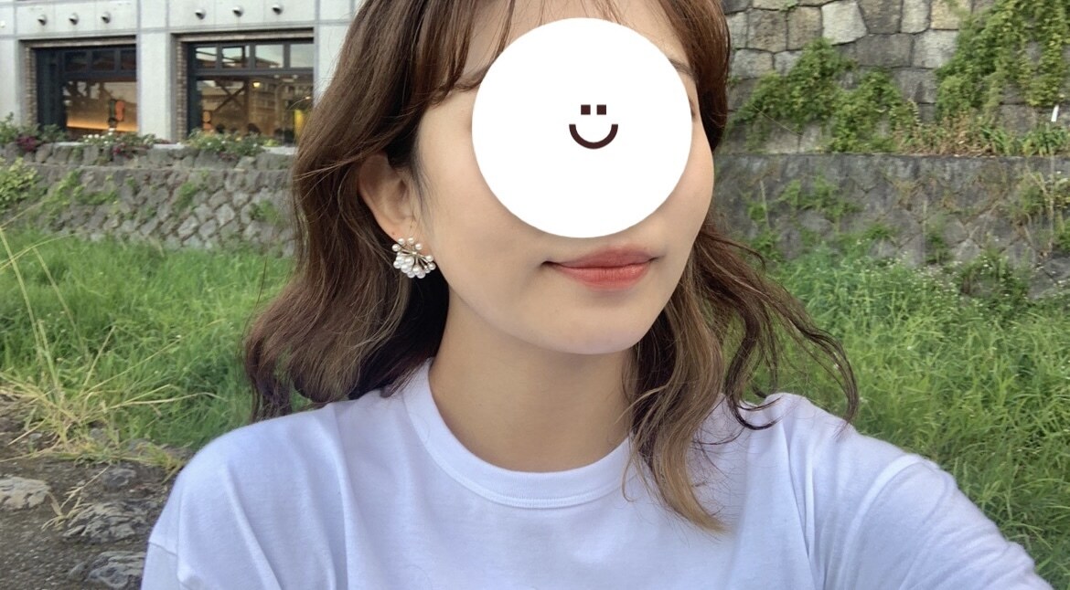 肌荒れの悩みお伺いします 大肌荒れした肌からたまご肌に戻れた秘訣教えます！ イメージ1