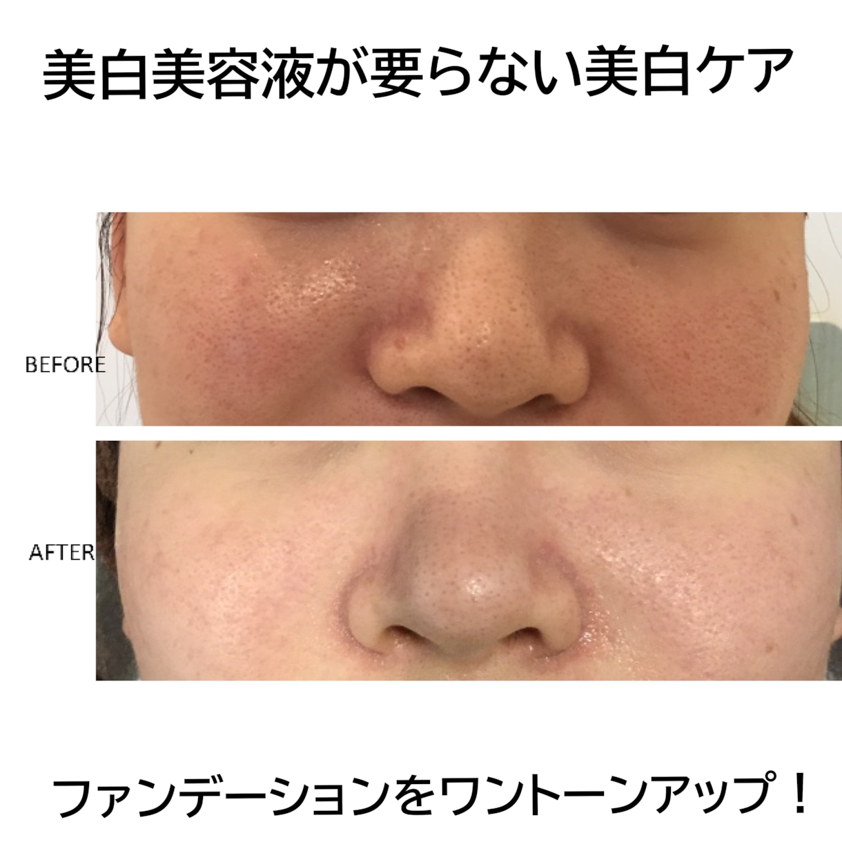 超敏感肌・アトピー肌のホームケをお教え致します ひとりひとりの生活に合わせたホームケアとスキンケアをご紹介 イメージ10