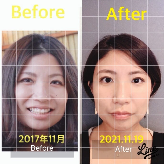 顔ヨガ◡̈ あなたのお悩みお手伝いさせて頂きます 1日2~3分家事しながらできる！顔ヨガ！ イメージ2