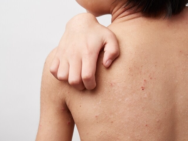 アレルギー克服体験からアトピーの治し方を提供します 薬を使わず、原因は何か。常識を疑い・食生活改善を提案します。 イメージ7