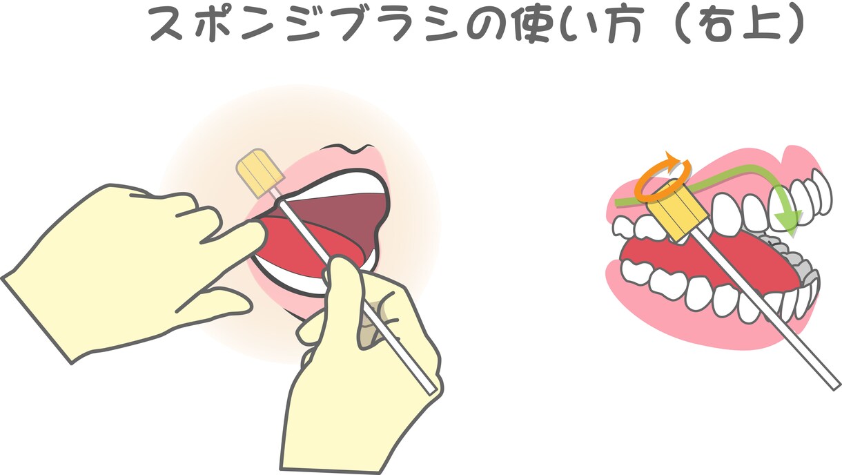 歯科関連の動くベクターイラストを描きます 患者説明に最適！歯科衛生士が作る動くイラスト イメージ2