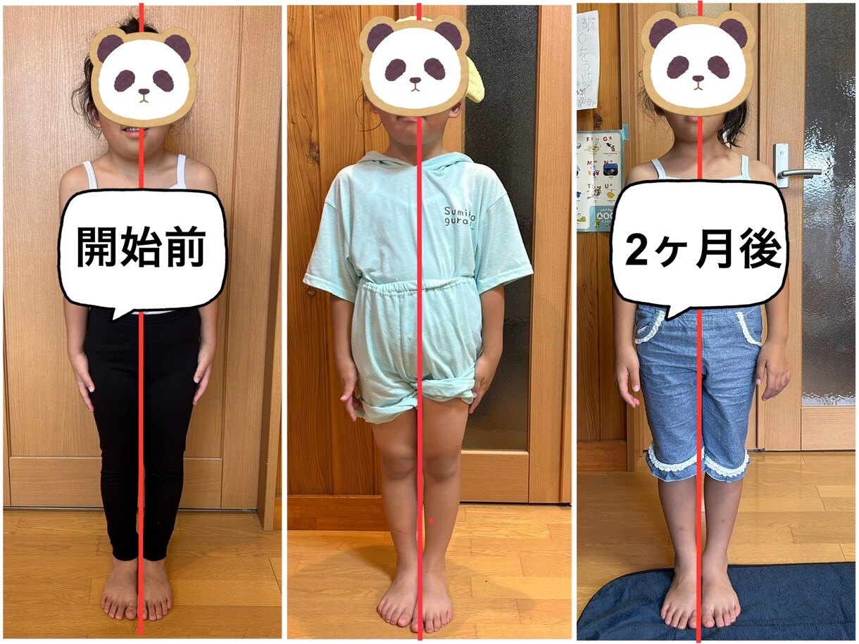 お口のお悩み(歯磨き.歯並び.離乳食)相談承ります ＊全身の発達＆姿勢から矯正なしのお口を育てる歯科衛生士が対応 イメージ3
