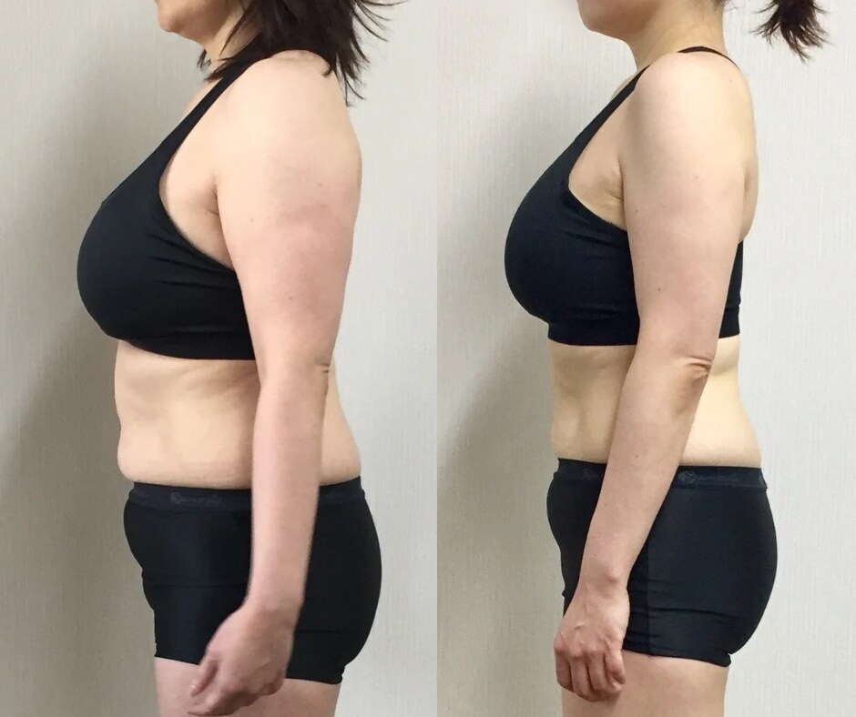 食事アドバイスと宅トレ／万年ダイエット卒業します 30分ヒヤリング（太るクセみつけます）30分エクササイズ イメージ4